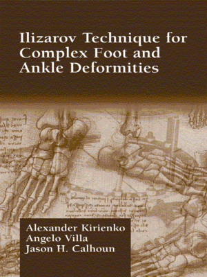 cover image of Ilizarov Technique for Complex Foot and Ankle Deformities